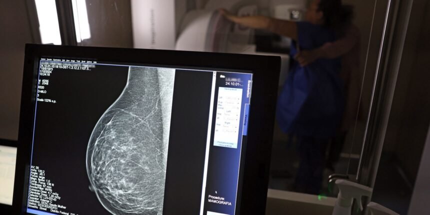 Ministério da Saúde começa a indicar mamografia para mulheres a partir dos 40 anos.