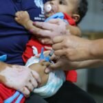 Coqueluche: Explosão de Casos Infantis Alarma com Internações e Óbitos